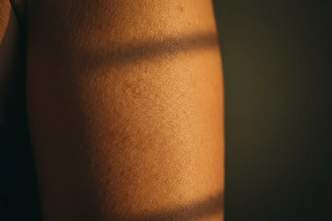 Close-up of sun-damaged skin showing signs of solar keratosis — rough, scaly patch on sun-exposed skin